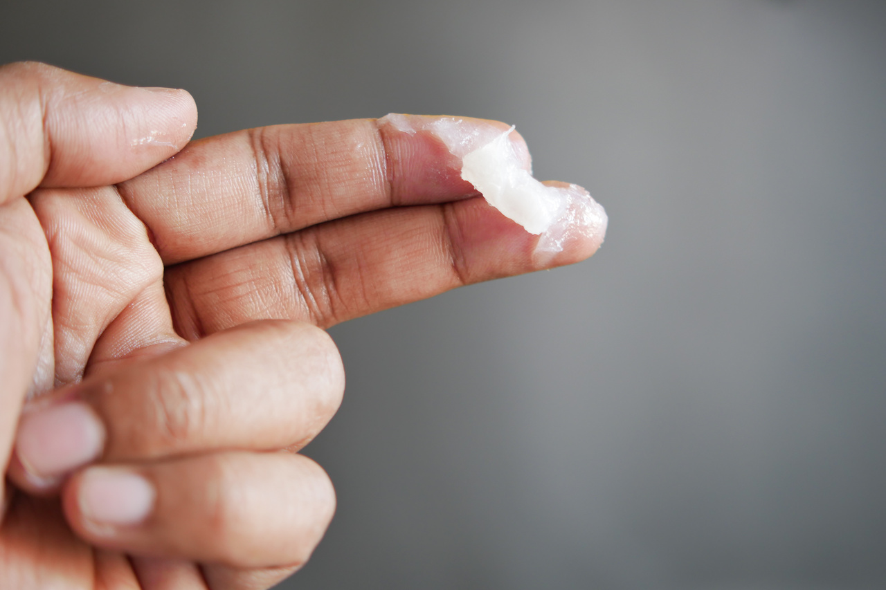 Home 13 close-up-of-man-hand-using-petroleum-jelly-2024-12-13-01-43-09-utc_Easy-Resize.com